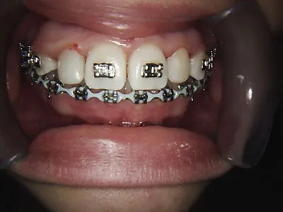 Case study - after photo