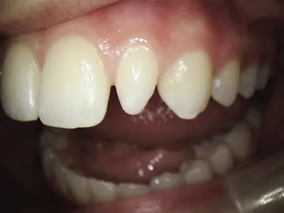 Case study - before photo
