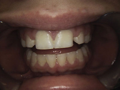 Case study - before photo