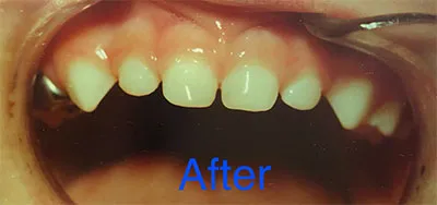 Case study - after photo