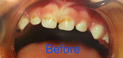 Case study - before photo