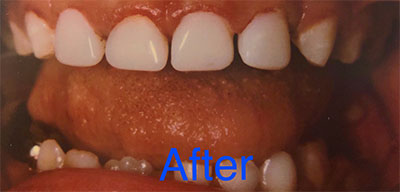 Case study - after photo