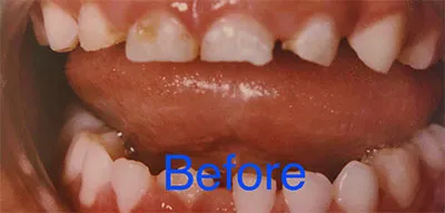 Case study - before photo